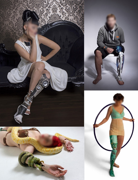 alternative limb project